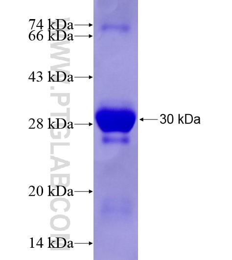 PREB fusion protein Ag28549 SDS-PAGE