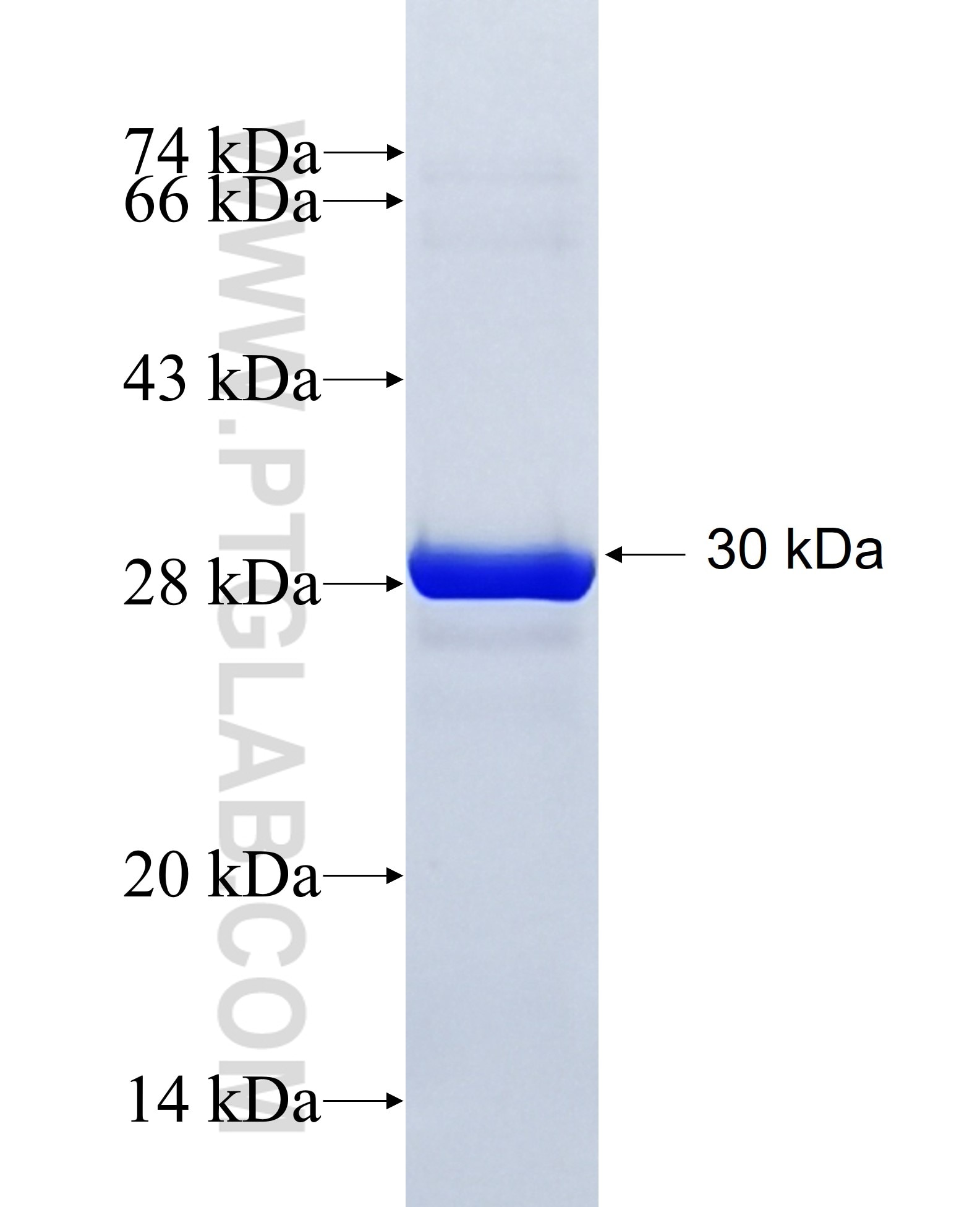 PREB fusion protein Ag28549 SDS-PAGE