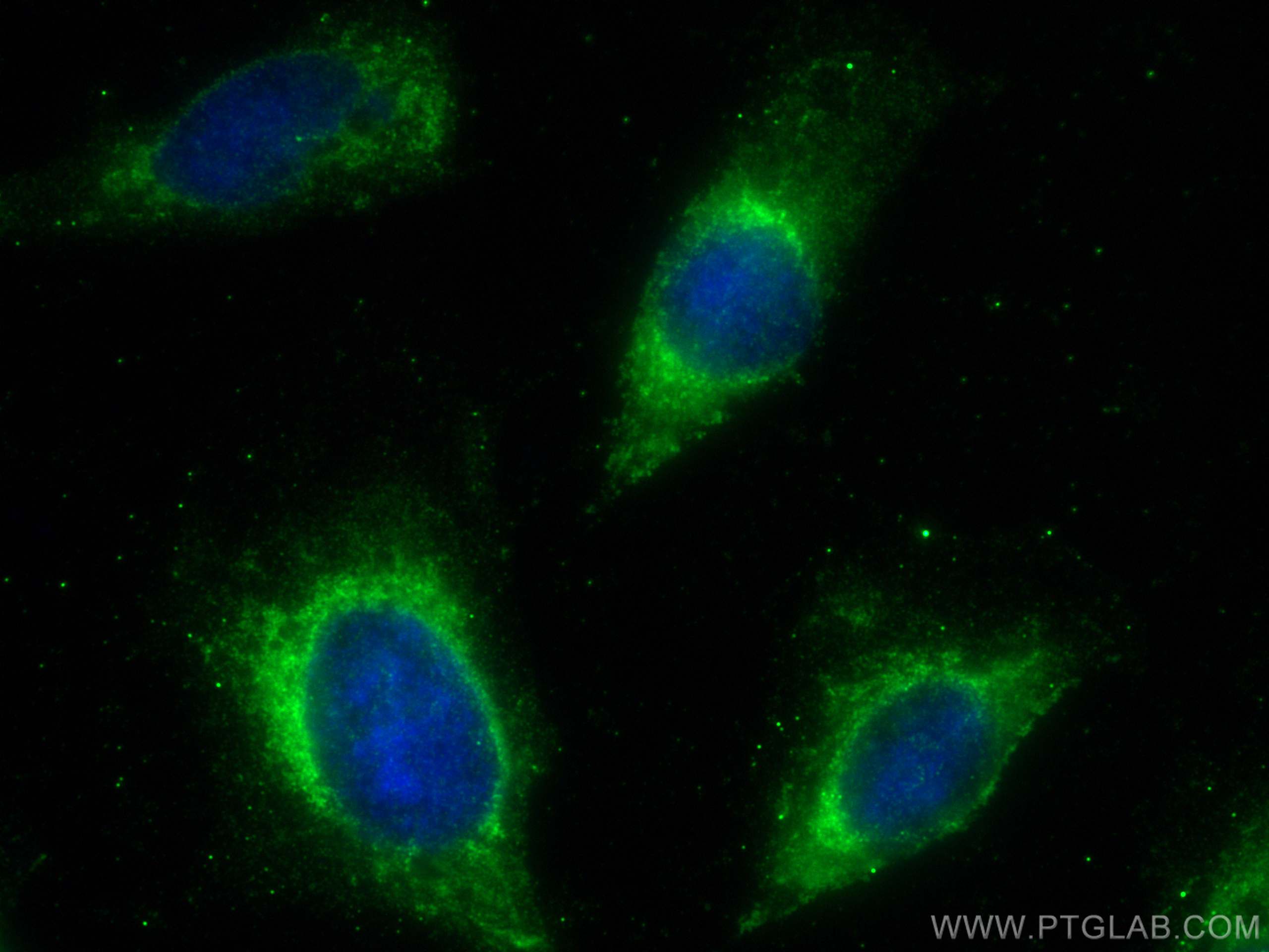 Immunofluorescence (IF) / fluorescent staining of U2OS cells using PRELP Polyclonal antibody (23783-1-AP)