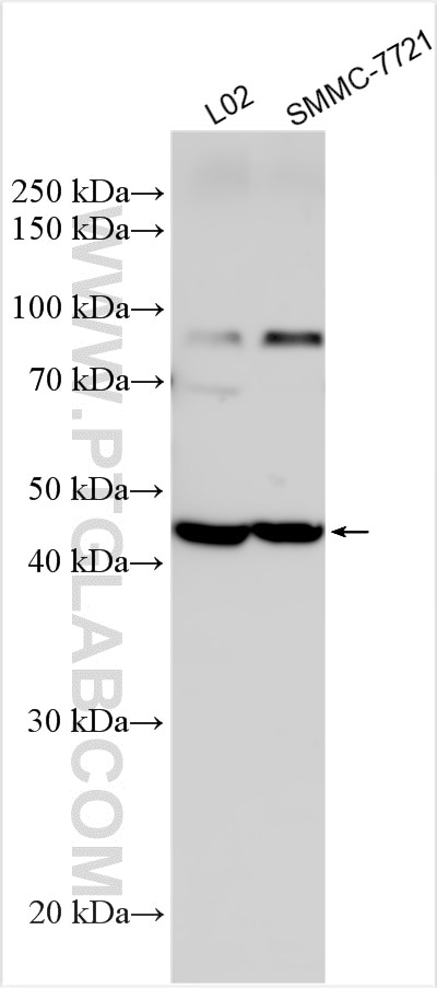 Western Blot (WB) analysis of various lysates using PRELP Polyclonal antibody (23783-1-AP)