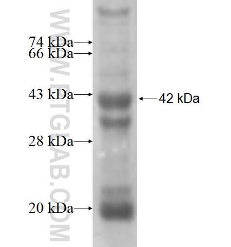PRELP fusion protein Ag4637 SDS-PAGE PRELP fusion protein Ag4637 SDS-PAGE