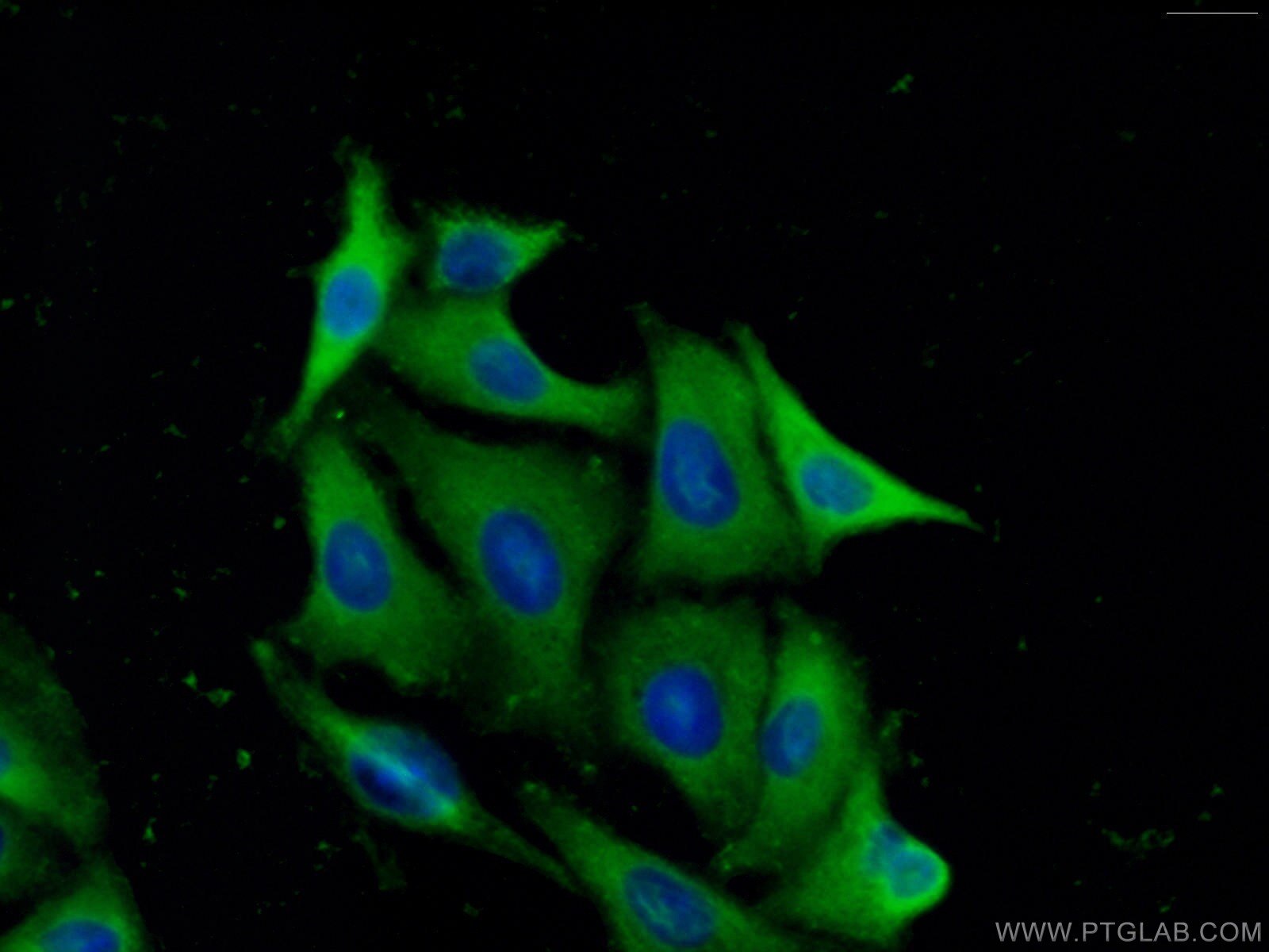 Immunofluorescence (IF) / fluorescent staining of A549 cells using PREP Polyclonal antibody (11536-1-AP)