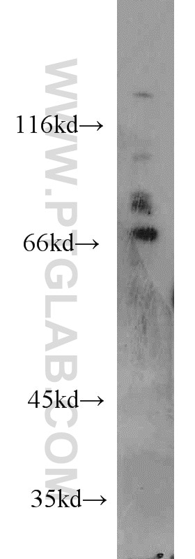Western Blot (WB) analysis of Jurkat cells using PREP Polyclonal antibody (11536-1-AP)