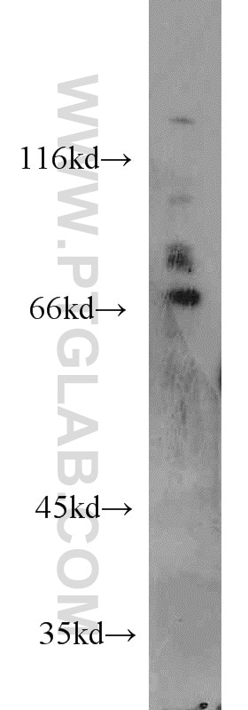 WB analysis of Jurkat using 11536-1-AP