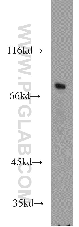 Western Blot (WB) analysis of mouse lung tissue using PREP Polyclonal antibody (11536-1-AP)