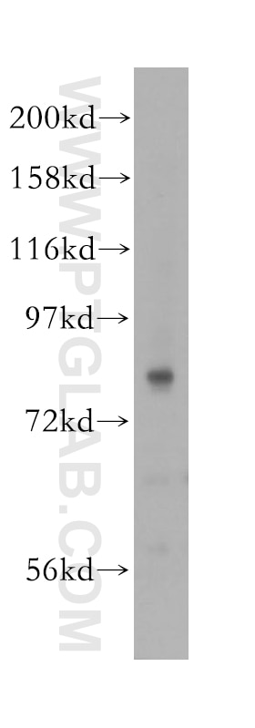 Western Blot (WB) analysis of human lung tissue using PREP Polyclonal antibody (11536-1-AP)