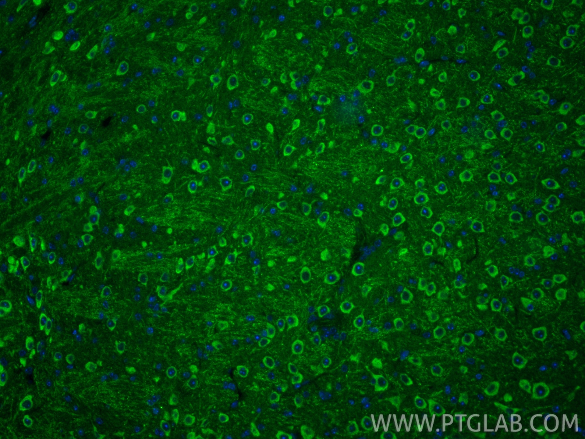 IF Staining of mouse brain using 12478-1-AP Immunofluorescence (IF) / fluorescent staining of mouse brain tissue using PREPL Polyclonal antibody (12478-1-AP)