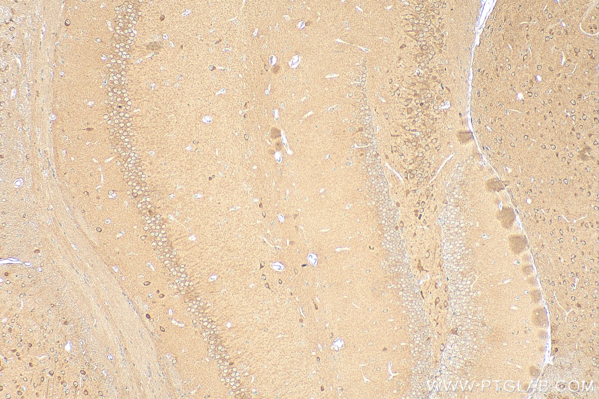Immunohistochemistry (IHC) staining of mouse brain tissue using PREPL Polyclonal antibody (12478-1-AP)
