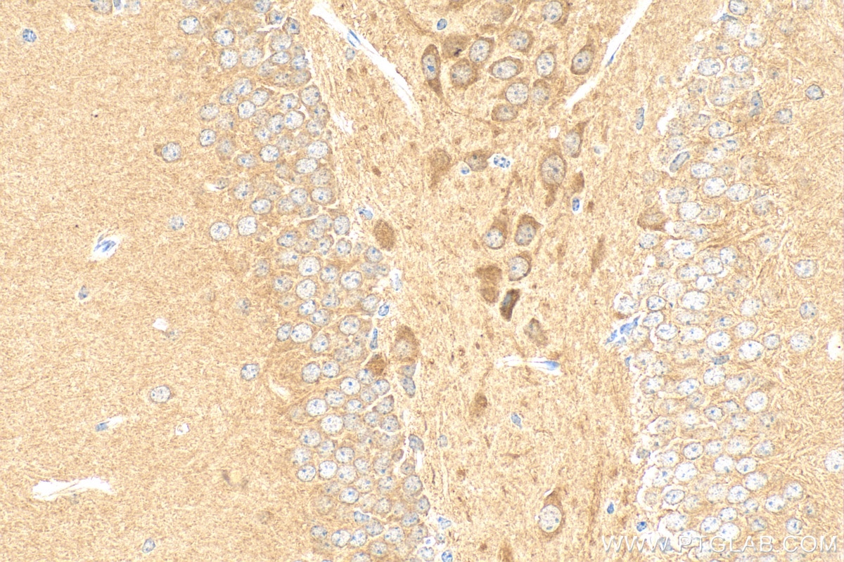 Immunohistochemistry (IHC) staining of mouse brain tissue using PREPL Polyclonal antibody (12478-1-AP)