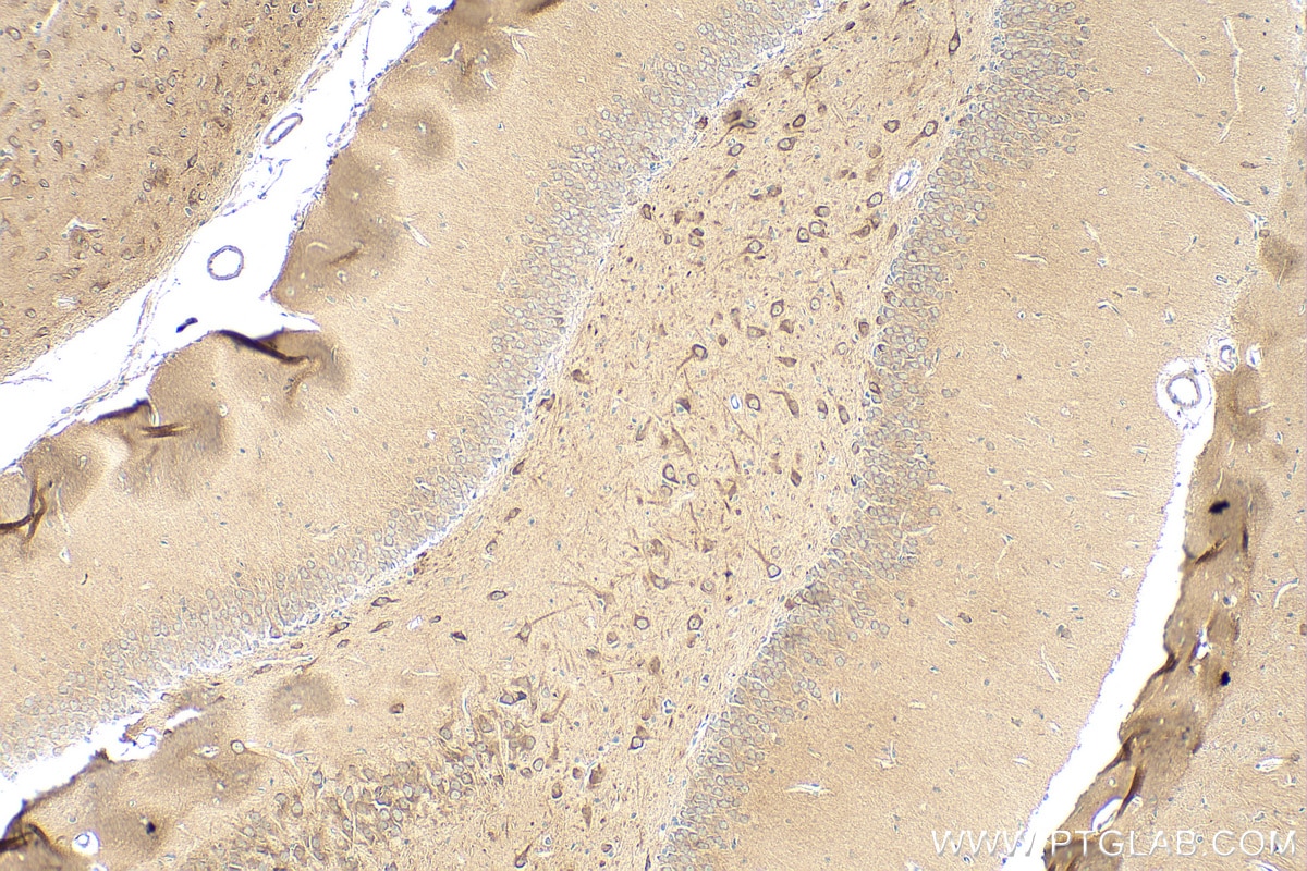 Immunohistochemistry (IHC) staining of rat brain tissue using PREPL Polyclonal antibody (12478-1-AP)