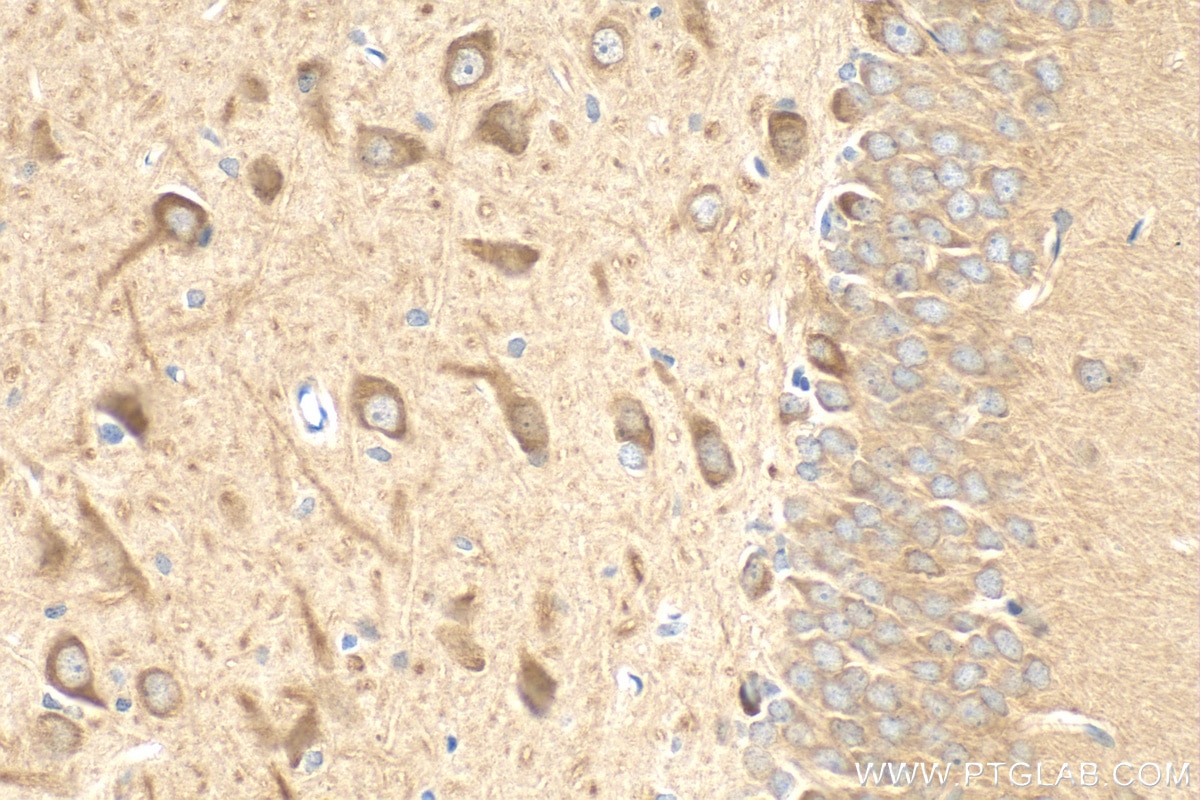 Immunohistochemistry (IHC) staining of rat brain tissue using PREPL Polyclonal antibody (12478-1-AP)