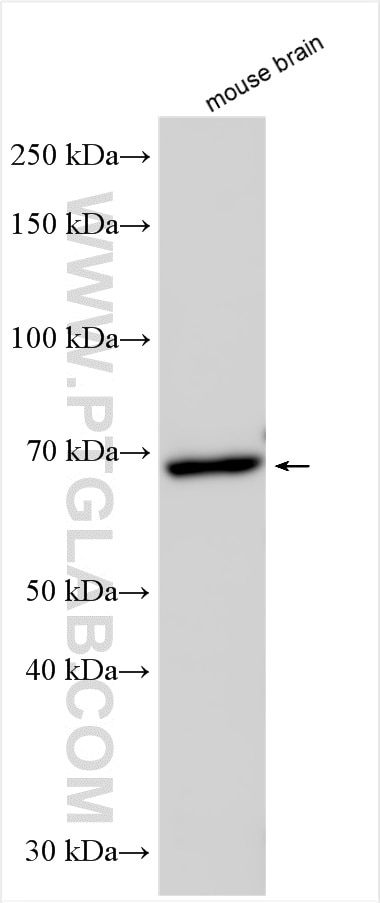 Western Blot (WB) analysis of mouse brain tissue using PREPL Polyclonal antibody (12478-1-AP)
