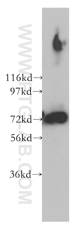 Western Blot (WB) analysis of human brain tissue using PREPL Polyclonal antibody (12478-1-AP)