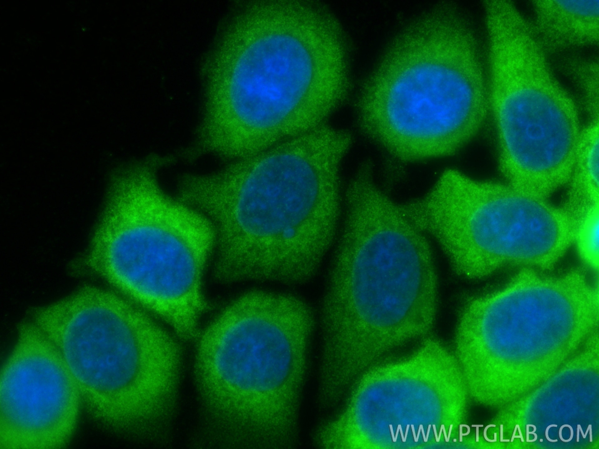 Immunofluorescence (IF) / fluorescent staining of MCF-7 cells using PREX1 Polyclonal antibody (33193-1-AP)