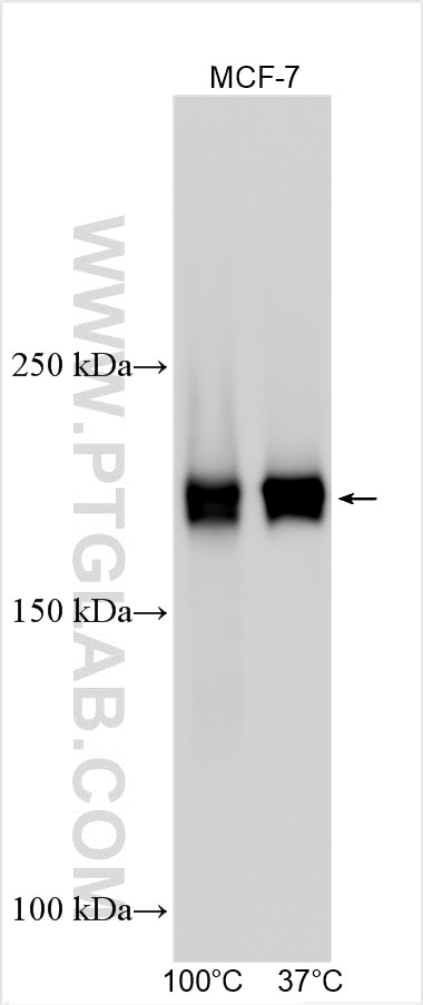 Western Blot (WB) analysis of various lysates using PREX1 Polyclonal antibody (33193-1-AP)