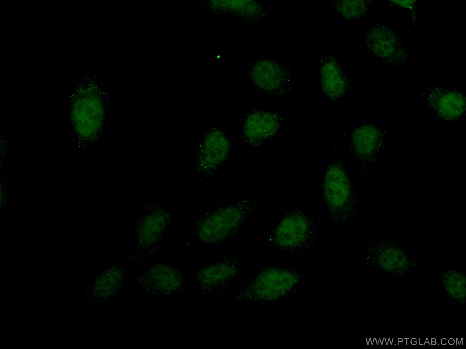 Immunofluorescence (IF) / fluorescent staining of U2OS cells using PREX2 Polyclonal antibody (24195-1-AP)