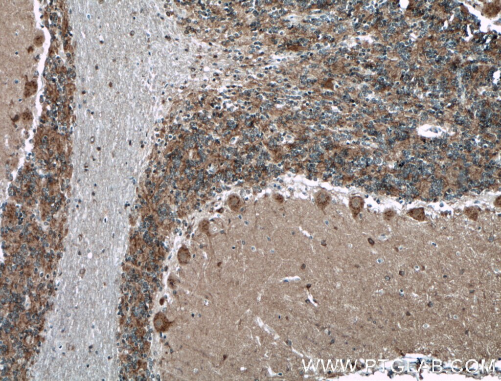 Immunohistochemistry (IHC) staining of human cerebellum tissue using PREX2 Polyclonal antibody (24195-1-AP)