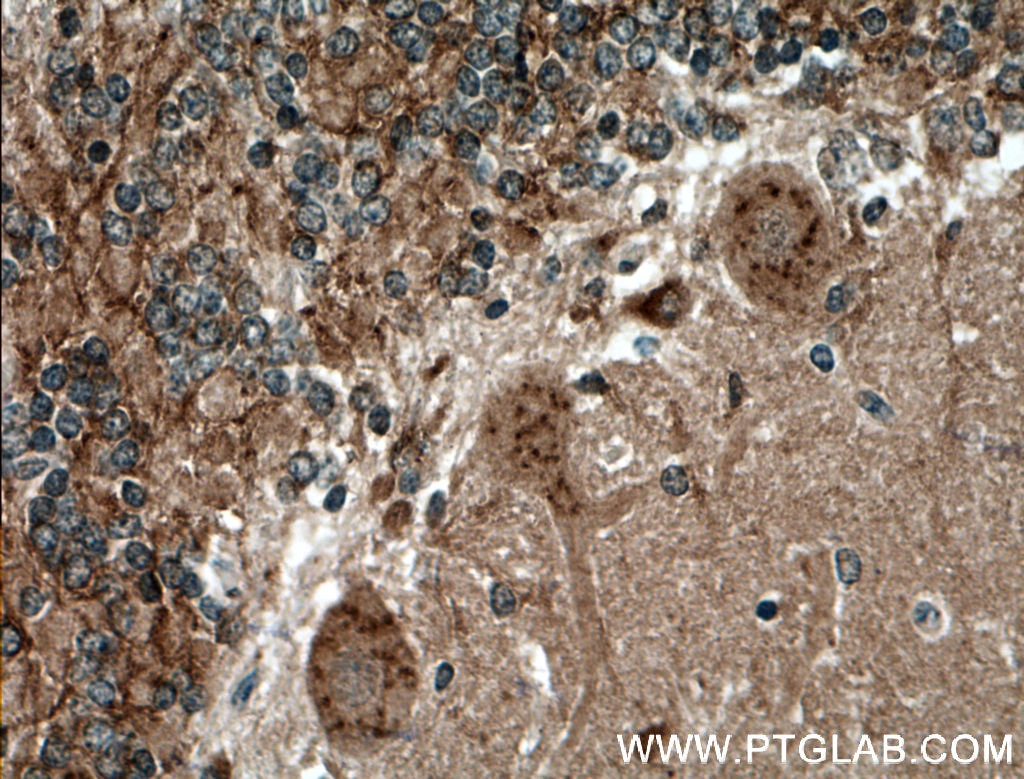 Immunohistochemistry (IHC) staining of human cerebellum tissue using PREX2 Polyclonal antibody (24195-1-AP)