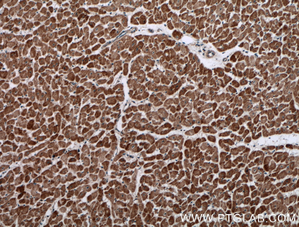 Immunohistochemistry (IHC) staining of human heart tissue using PREX2 Polyclonal antibody (24195-1-AP)