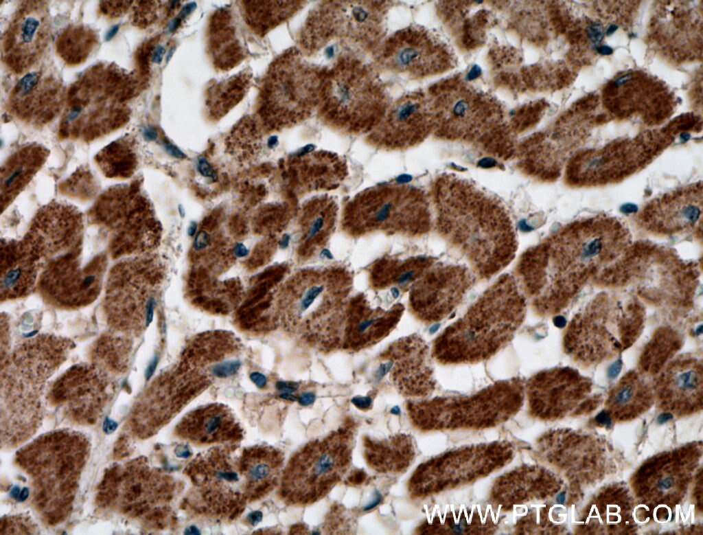 Immunohistochemistry (IHC) staining of human heart tissue using PREX2 Polyclonal antibody (24195-1-AP)