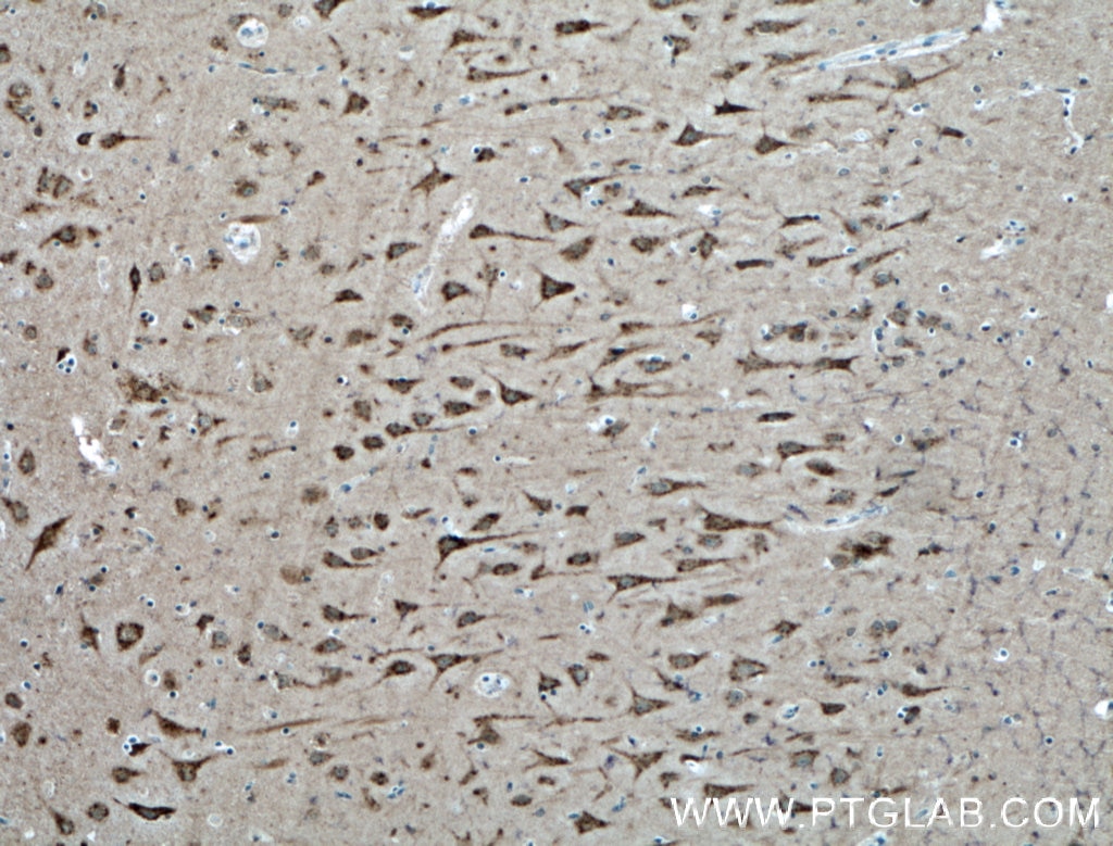 Immunohistochemistry (IHC) staining of human brain tissue using PREX2 Polyclonal antibody (24195-1-AP)