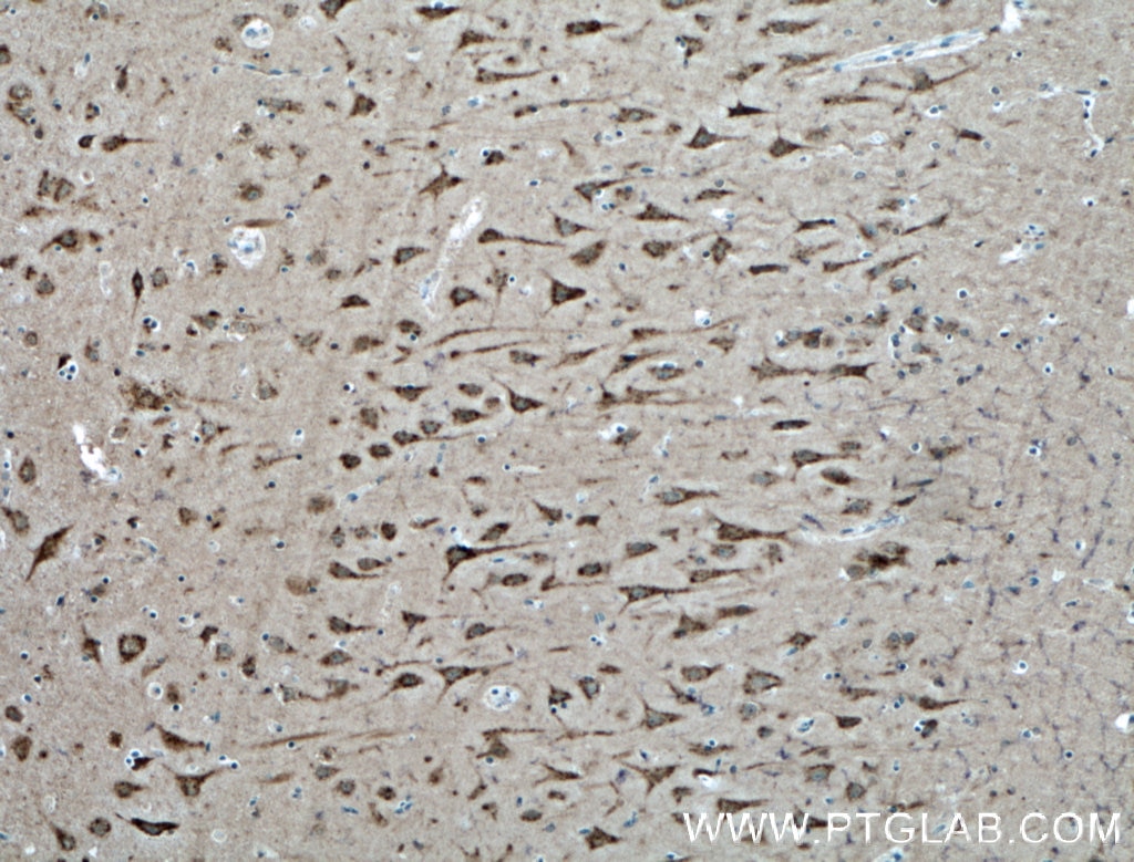 IHC staining of human brain using 24195-1-AP