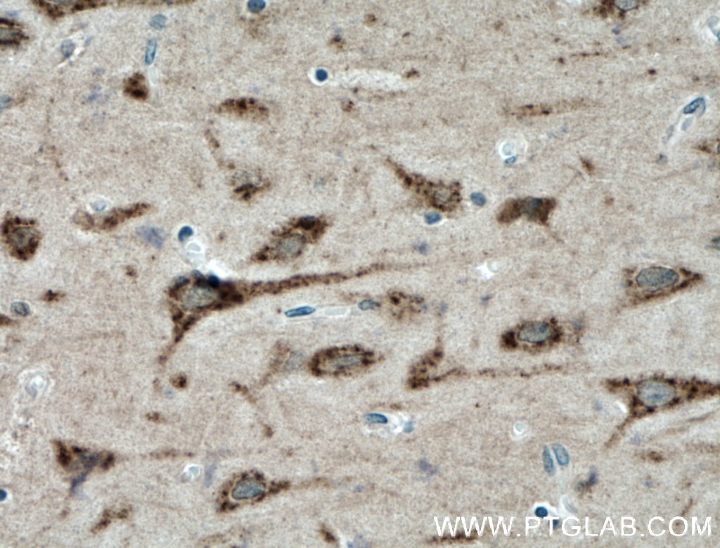 Immunohistochemistry (IHC) staining of human brain tissue using PREX2 Polyclonal antibody (24195-1-AP)
