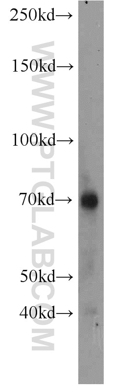 Western Blot (WB) analysis of mouse kidney tissue using Perforin Polyclonal antibody (14580-1-AP)
