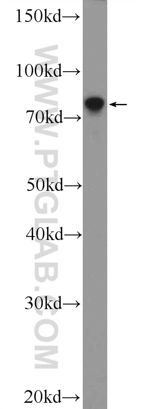 Western Blot (WB) analysis of HL-60 cells using LPPR3 Polyclonal antibody (25936-1-AP)