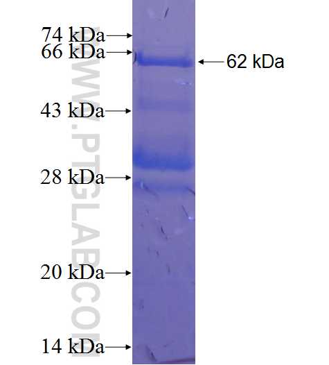 PRG2 fusion protein Ag22954 SDS-PAGE