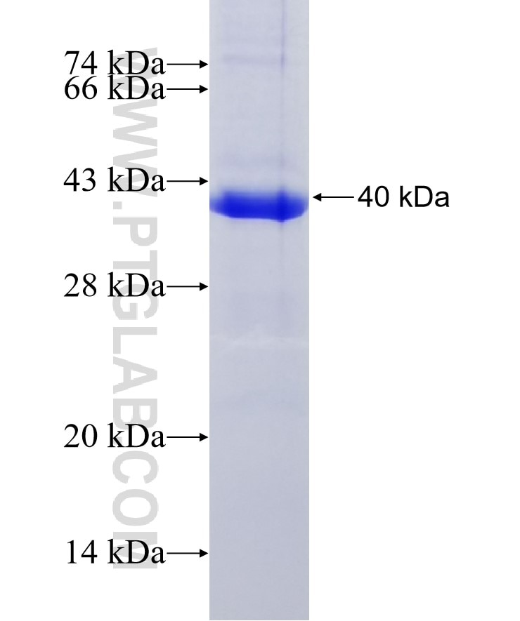 PRG2 fusion protein Ag24434 SDS-PAGE