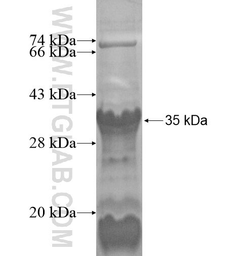 PRH1 fusion protein Ag14833 SDS-PAGE