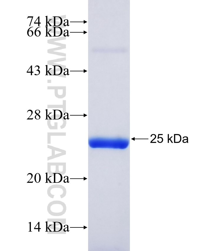 PRHOXNB fusion protein Ag37195 SDS-PAGE