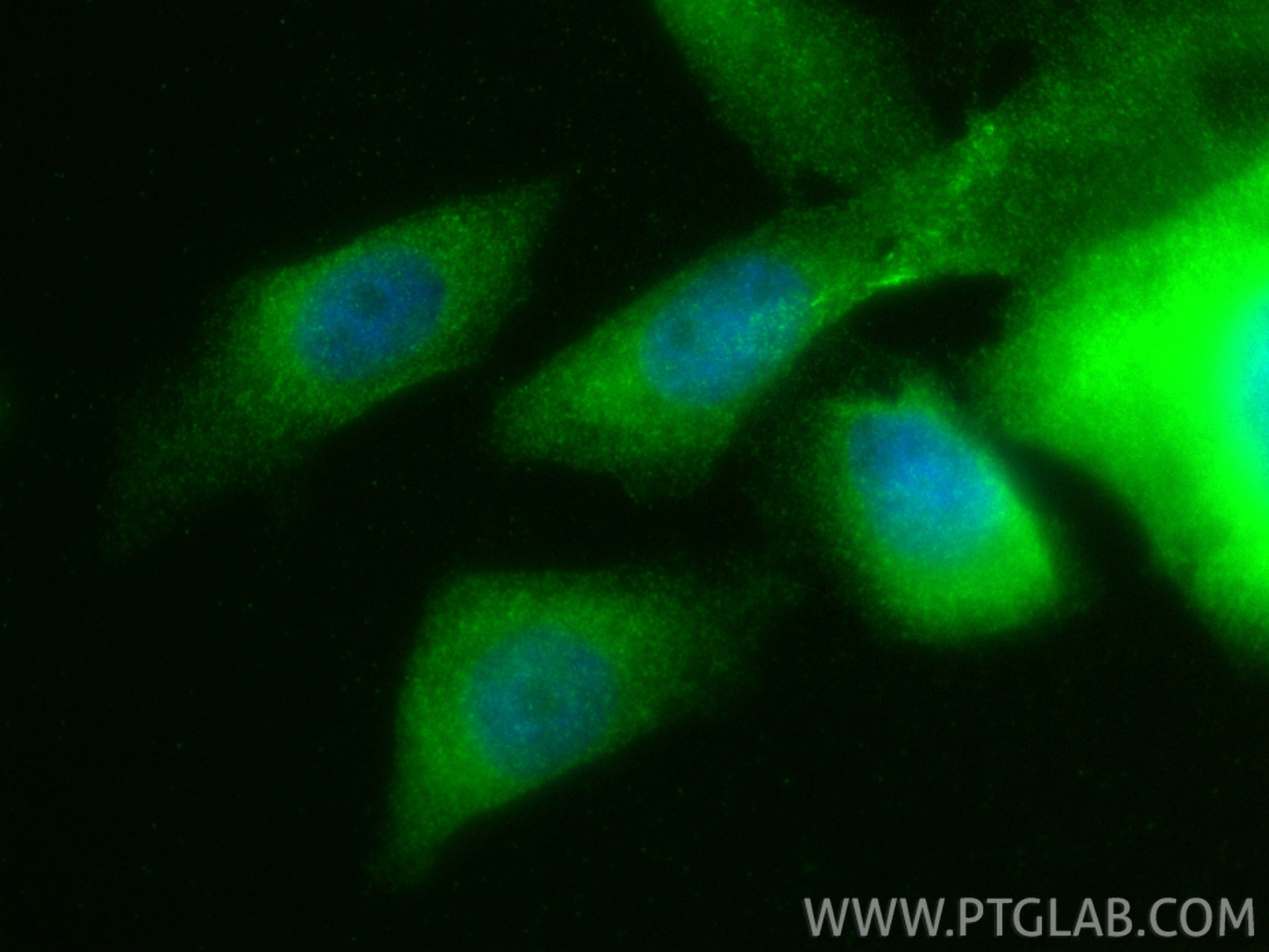Immunofluorescence (IF) / fluorescent staining of PC-3 cells using PRIC285 Polyclonal antibody (25736-1-AP)
