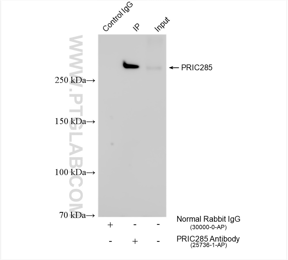 Immunoprecipitation (IP) experiment of PC-3 cells using PRIC285 Polyclonal antibody (25736-1-AP)