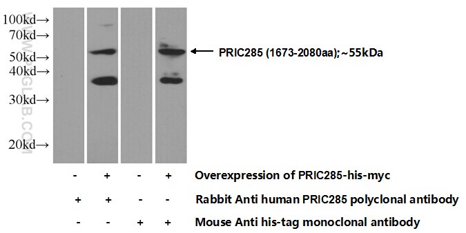 PRIC285