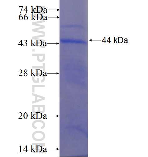 PRIC285 fusion protein Ag22719 SDS-PAGE