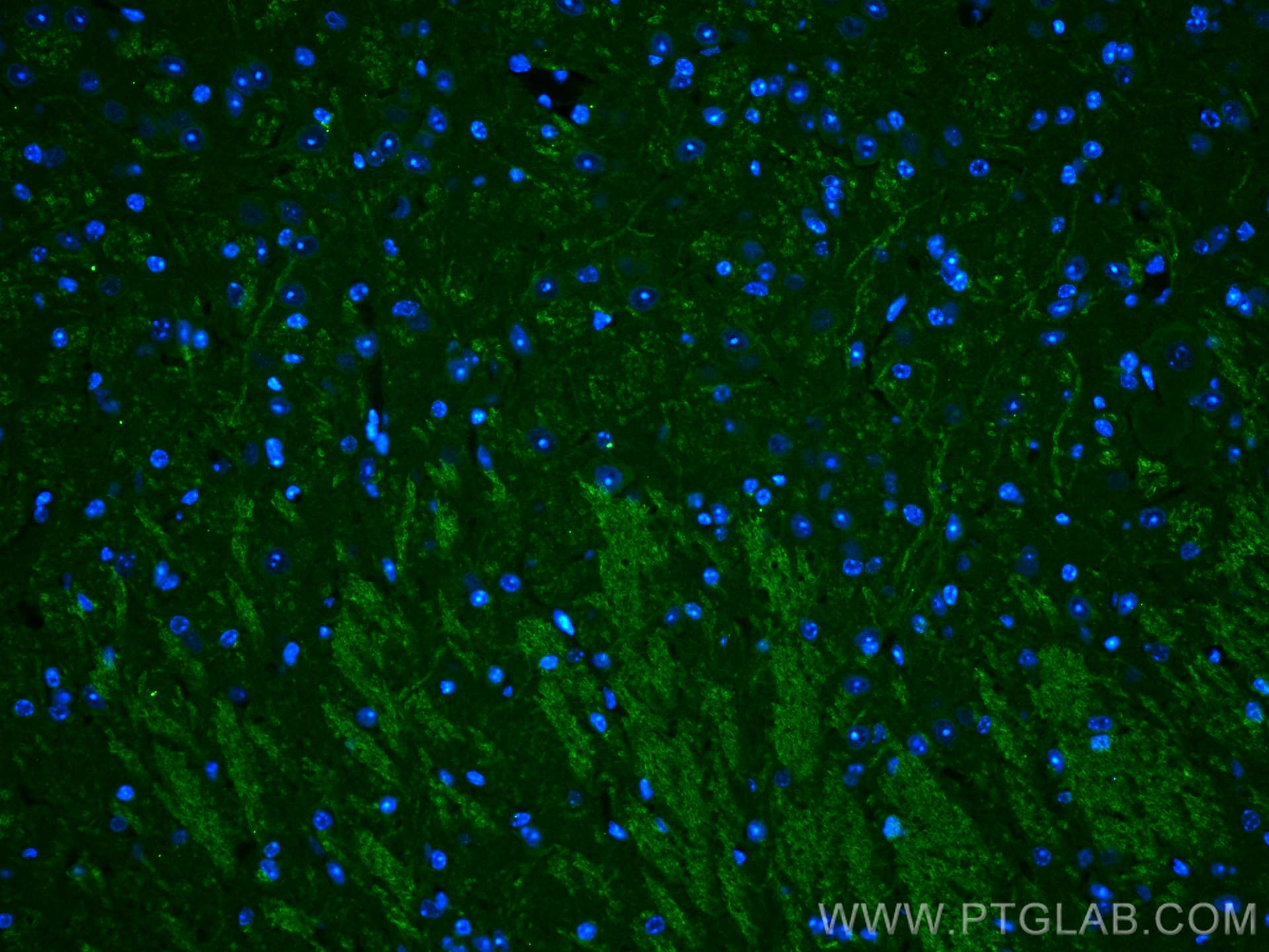 Immunofluorescence (IF) / fluorescent staining of mouse cerebellum tissue using PRICKLE1 Polyclonal antibody (22589-1-AP)