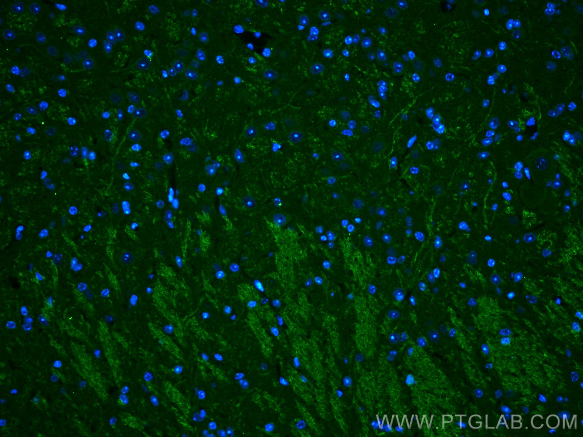 Immunofluorescence (IF) / fluorescent staining of mouse cerebellum tissue using PRICKLE1 Polyclonal antibody (22589-1-AP)