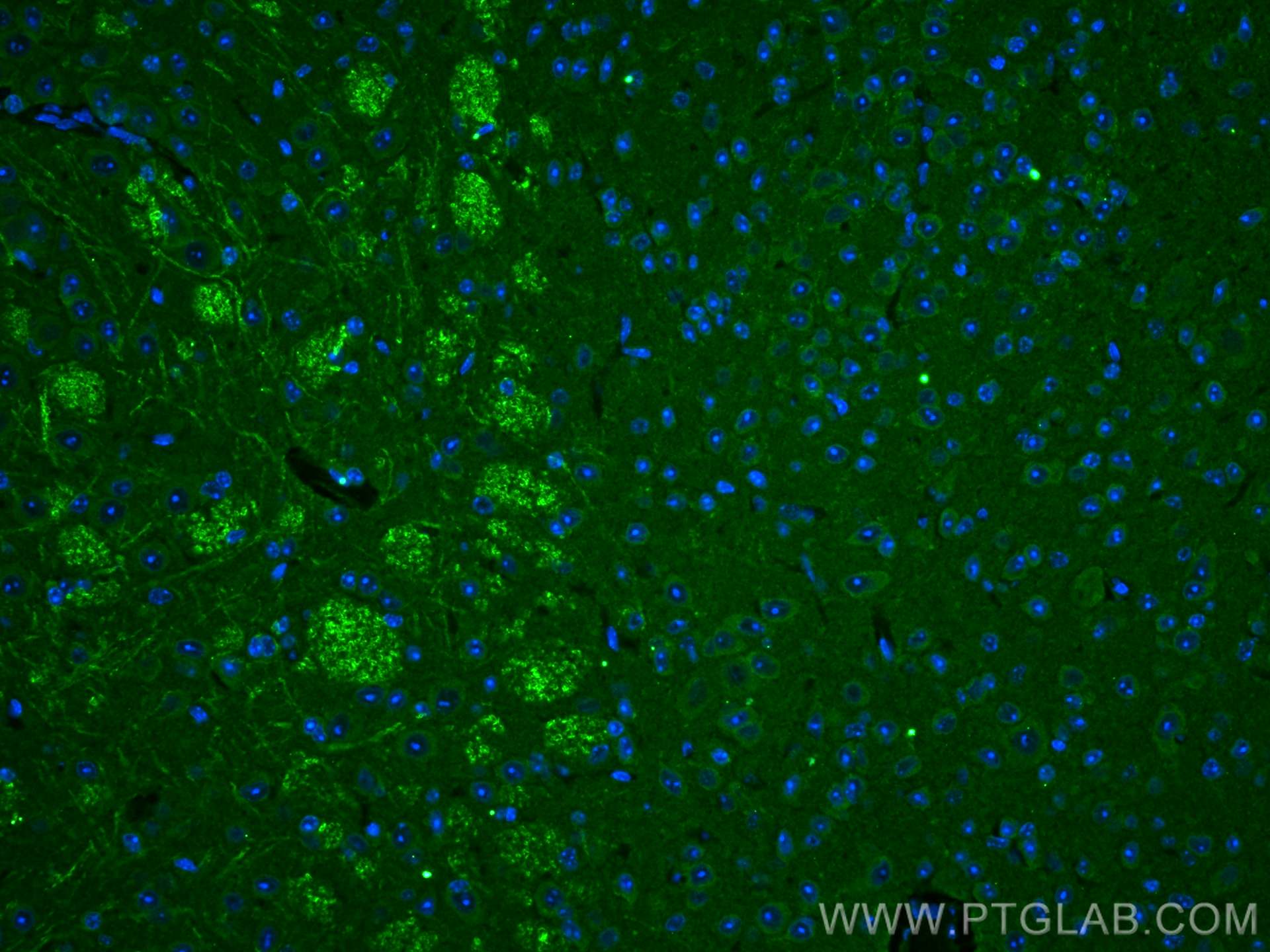 Immunofluorescence (IF) / fluorescent staining of mouse cerebellum tissue using PRICKLE1 Polyclonal antibody (22589-1-AP)