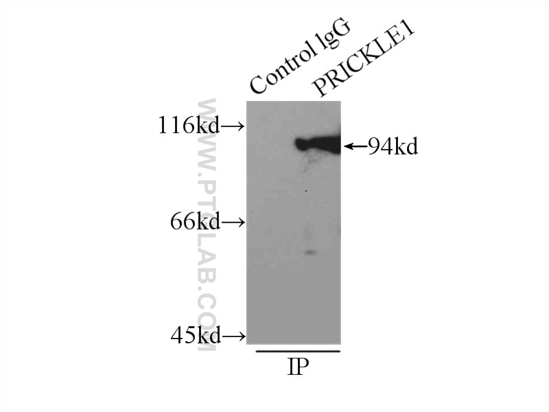 Immunoprecipitation (IP) experiment of mouse brain tissue using PRICKLE1 Polyclonal antibody (22589-1-AP)