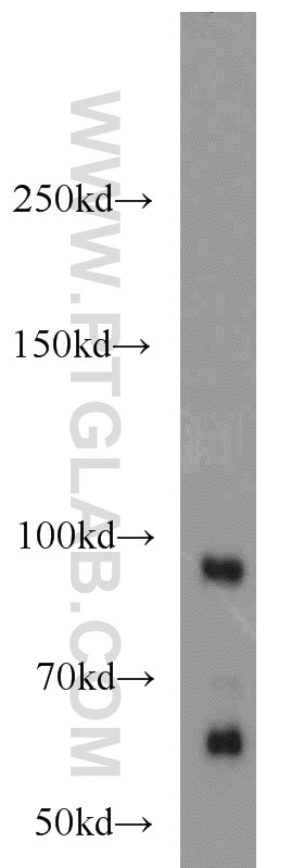 Western Blot (WB) analysis of mouse brain tissue using PRICKLE1 Polyclonal antibody (22589-1-AP)