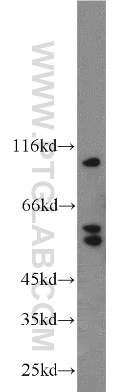 Western Blot (WB) analysis of Neuro-2a cells using PRICKLE1 Polyclonal antibody (22589-1-AP)