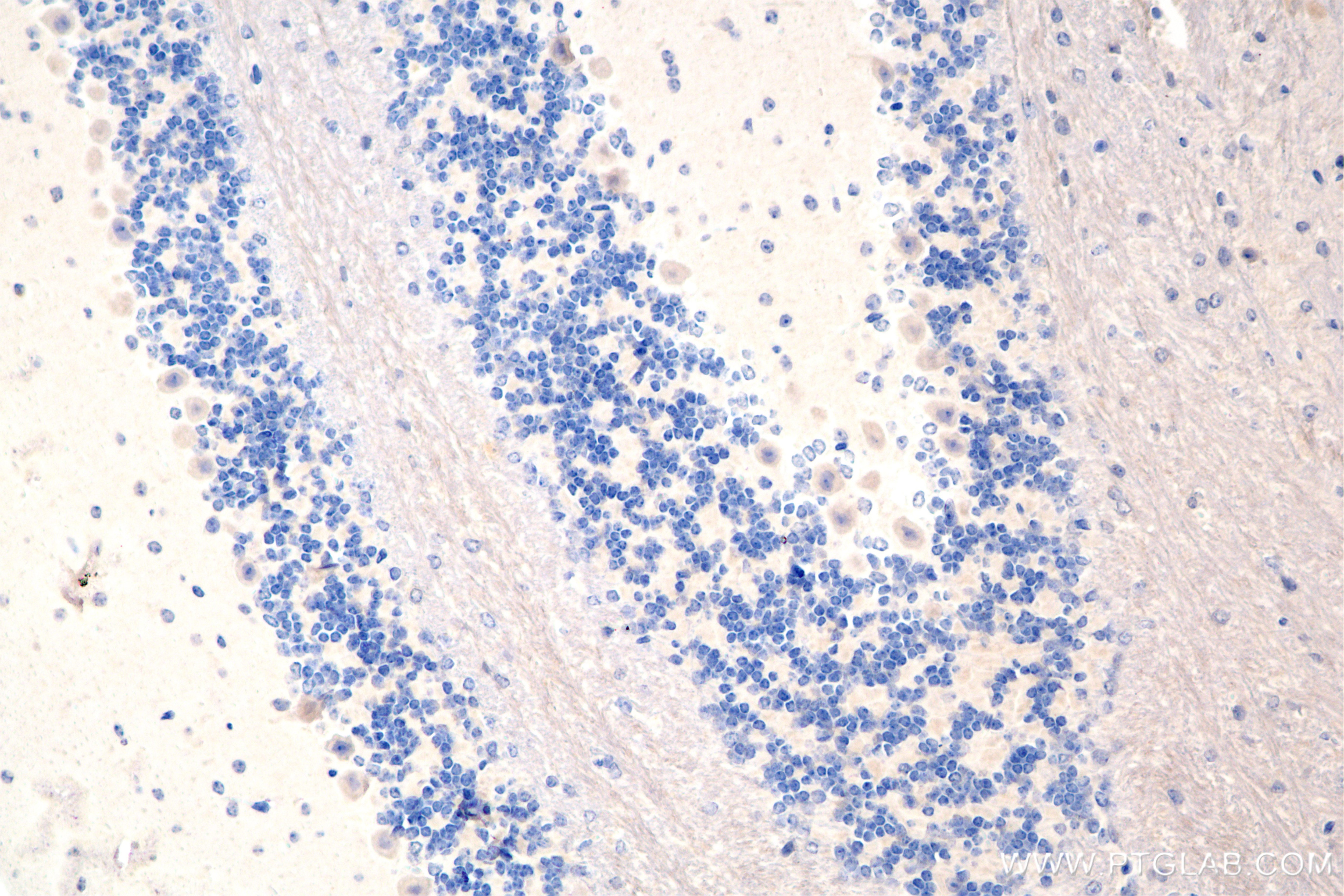Immunohistochemistry (IHC) staining of mouse cerebellum tissue using PRICKLE1 Recombinant antibody (84926-1-RR)