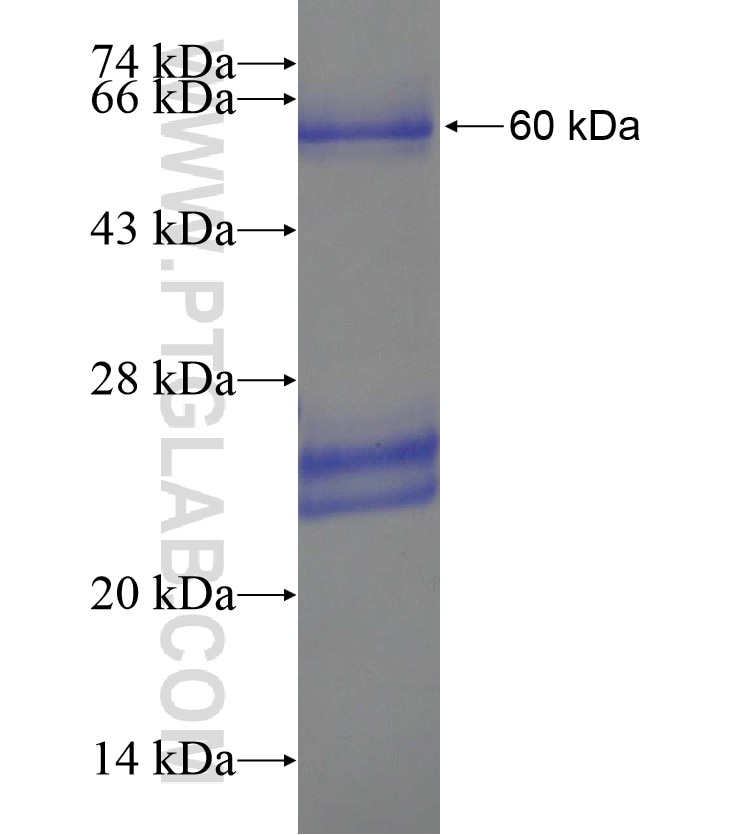 PRICKLE1 fusion protein Ag18407 SDS-PAGE