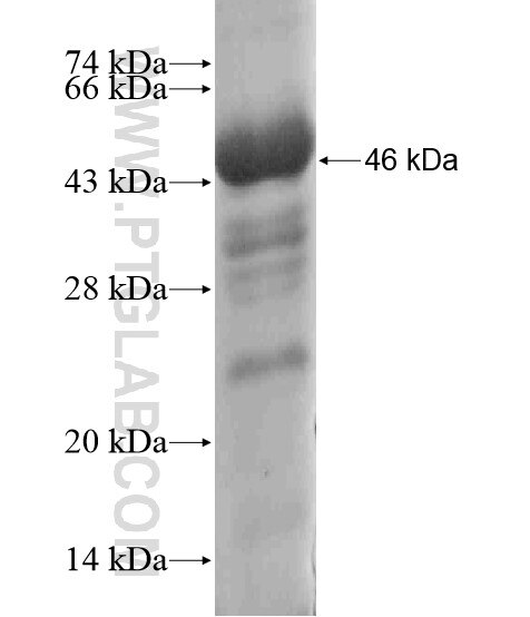 PRICKLE1 fusion protein Ag19573 SDS-PAGE