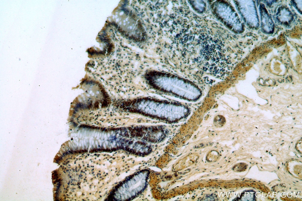 Immunohistochemistry (IHC) staining of human colon tissue using PRICKLE3 Polyclonal antibody (19098-1-AP)