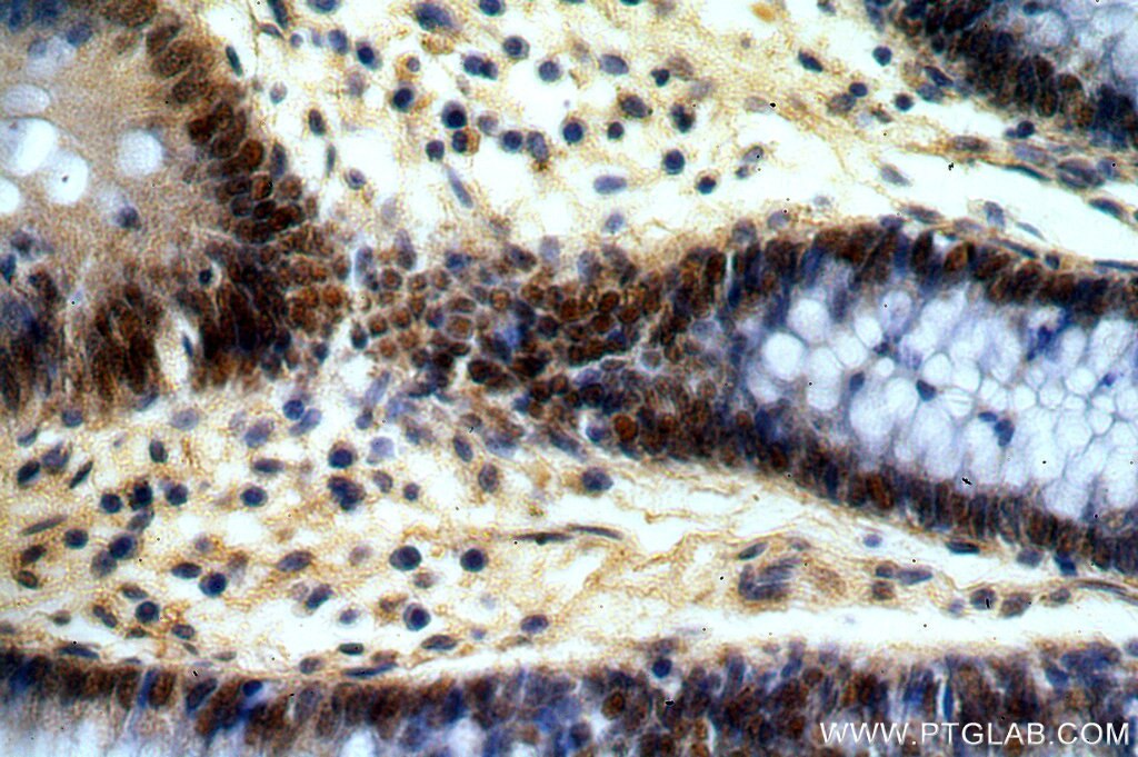 Immunohistochemistry (IHC) staining of human colon tissue using PRICKLE3 Polyclonal antibody (19098-1-AP)