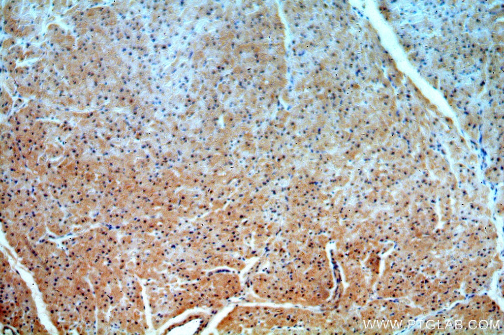 Immunohistochemistry (IHC) staining of human heart tissue using PRICKLE3 Polyclonal antibody (19098-1-AP)