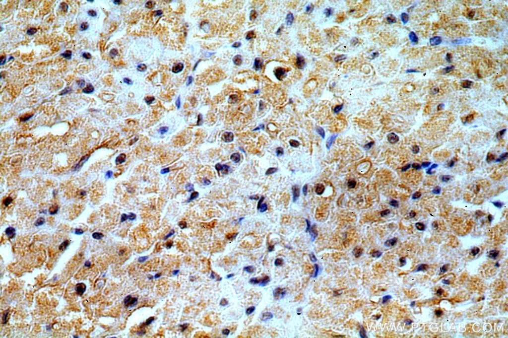 IHC staining of human heart using 19098-1-AP